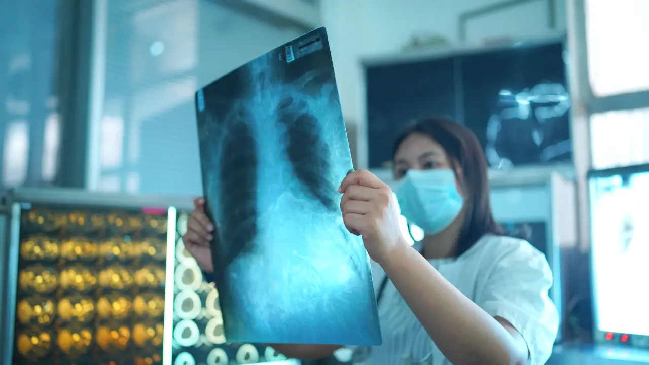 xray qc